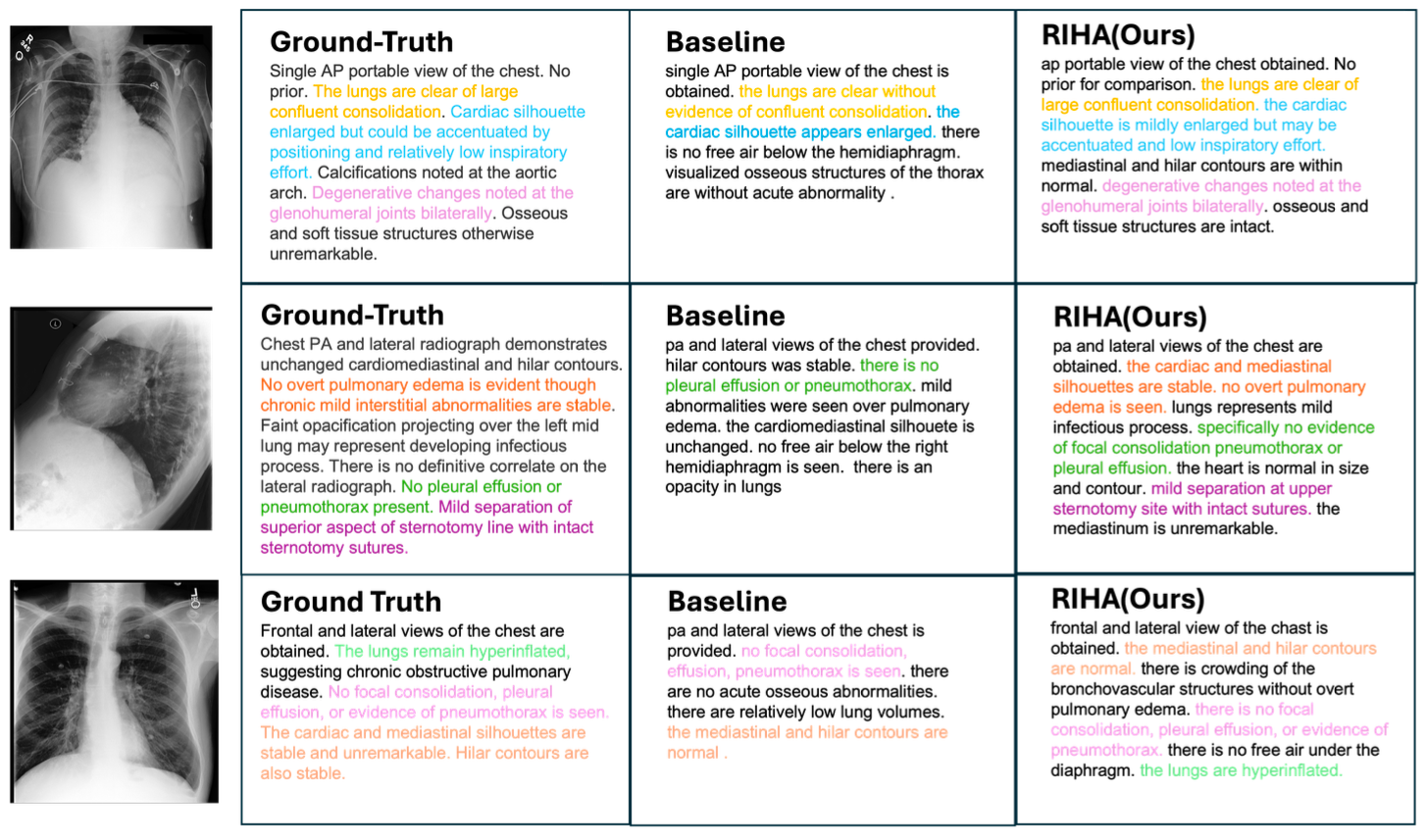 Cross-modal hierarchical alignment via optimal transport